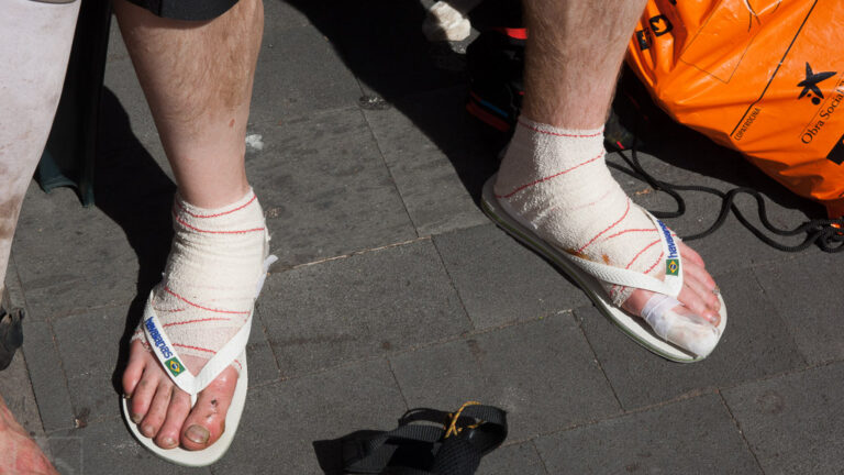 Foot care Transvulcania