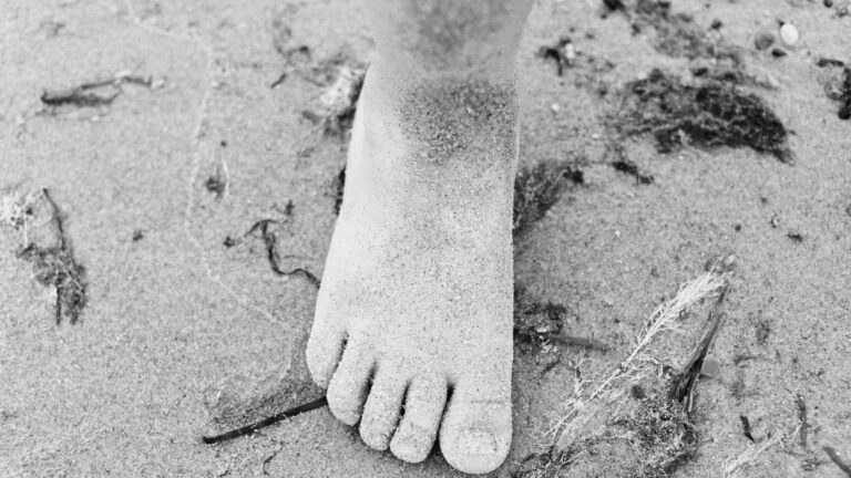 runner removing shoes after long run showing signs of toenail fungus and foot moisture